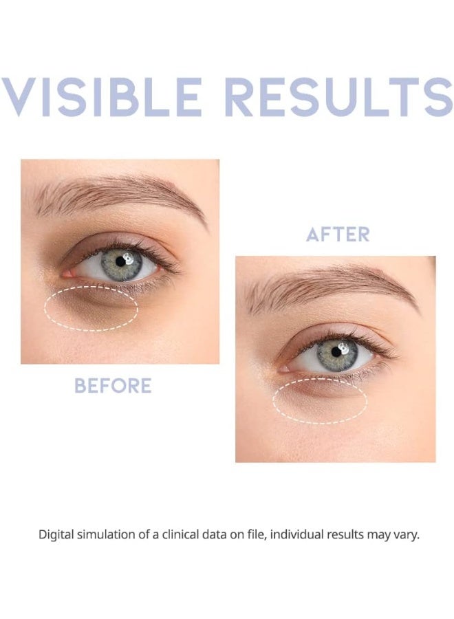 #OOTD سيروم كريم للعين نباتي من #OOTD مع حمض الهيالورونيك وفيتامين C والكافيين — 30 جم - Image 5